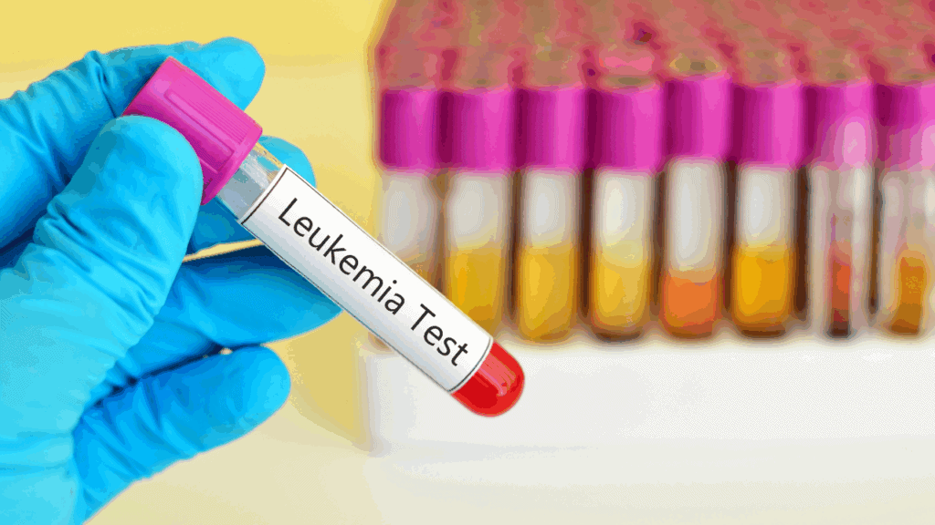 維持良好生活習慣病定期健康檢查才能確保身體健康無虞。若發現疑似白血病症狀應立即就醫。